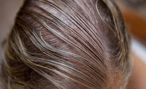 Thinning Hair Renew